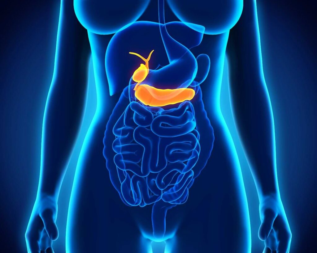 דלקת בכיס המרה